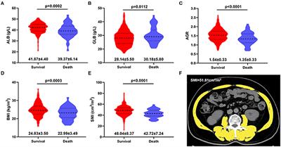 Combination of Albumin-Globulin Score and Sarcopenia to Predict Prognosis in Patients With Renal Cell Carcinoma Undergoing Laparoscopic Nephrectomy